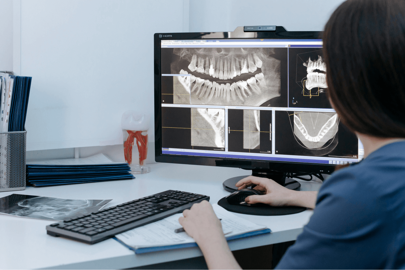 Find the best x-ray plate scanner